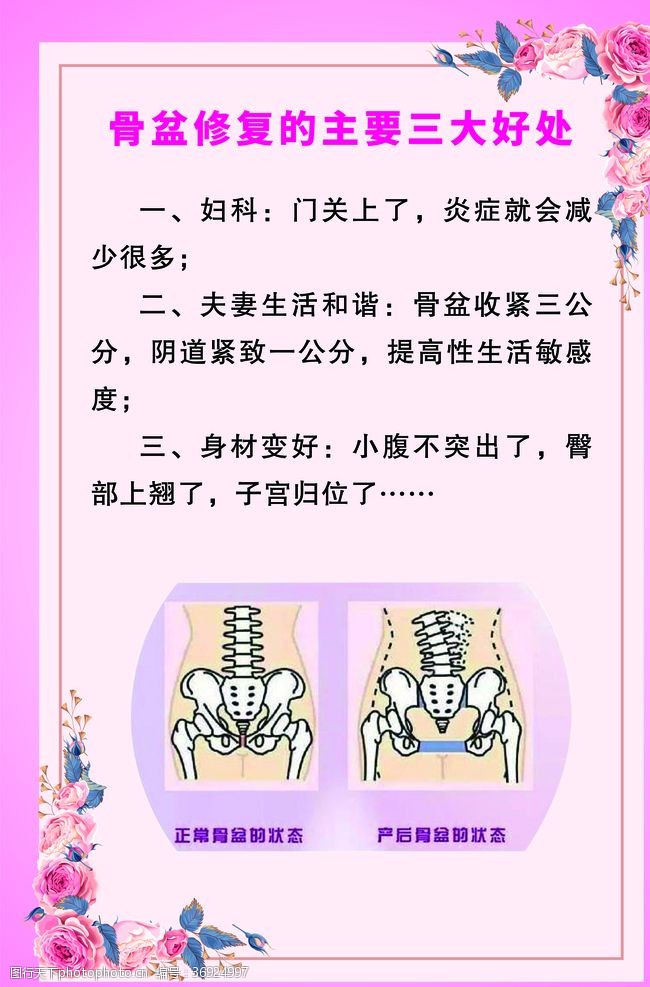 骨盆修复三大好处